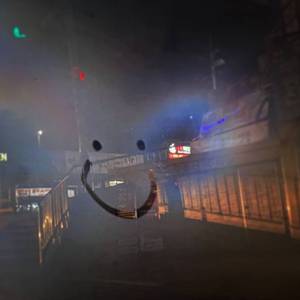 女性肛交一次肛门多久恢复
