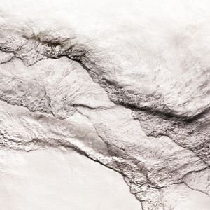 女性肛交一次肛门多久恢复
